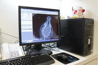 數位影像讀片系統