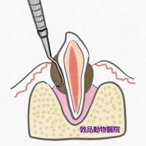 狗牙齒使用牙齦下刮刀清潔牙結石