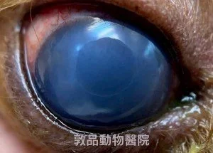 角膜水腫 藍眼症