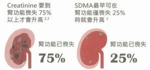 SDMA腎功能喪失圖